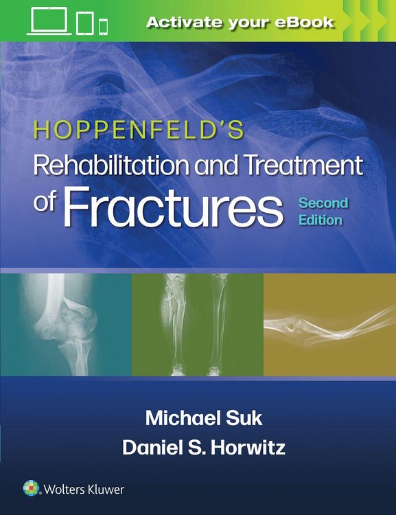 Produktbild: Hoppenfeld's Treatment and Rehabilitation of Fractures