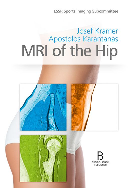 Produktbild: MRI of the Hip