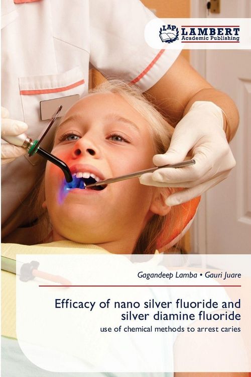 Produktbild: Efficacy of nano silver fluoride and silver diamine fluoride