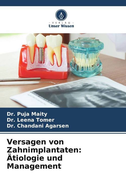 Produktbild: Versagen von Zahnimplantaten: &Auml;tiologie und Management