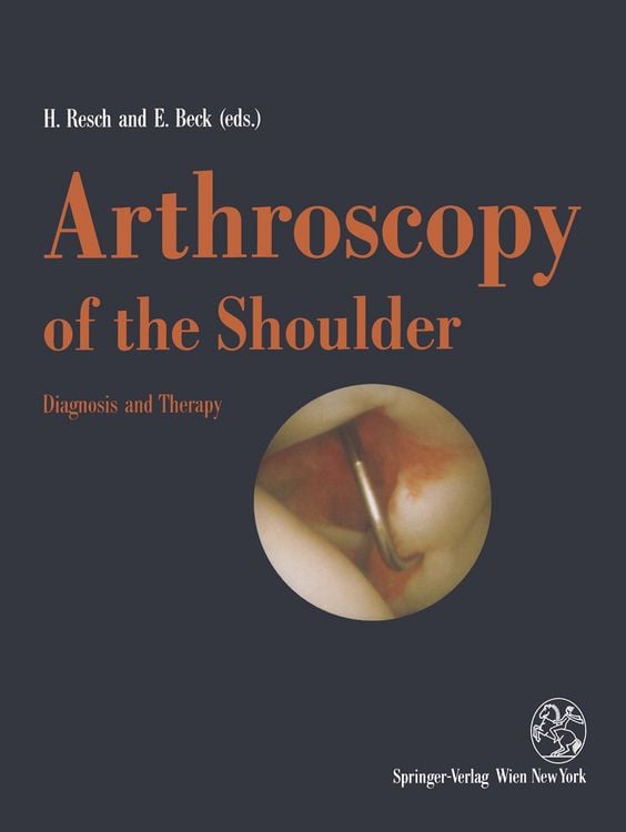 Produktbild: Arthroscopy of the Shoulder