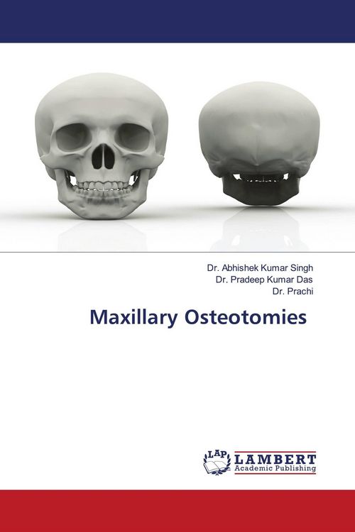 Produktbild: Maxillary Osteotomies