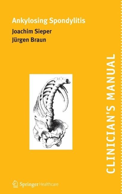 Produktbild: Clinician's Manual on Ankylosing Spondylitis