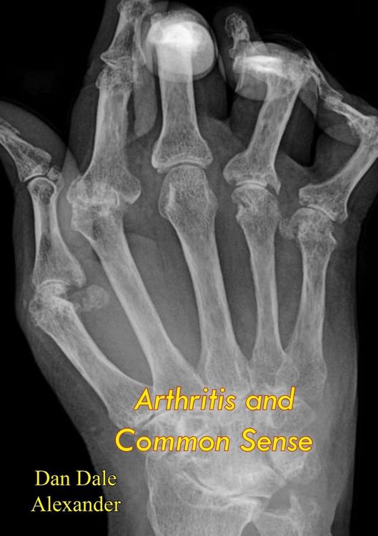 Produktbild: Arthritis and Common Sense