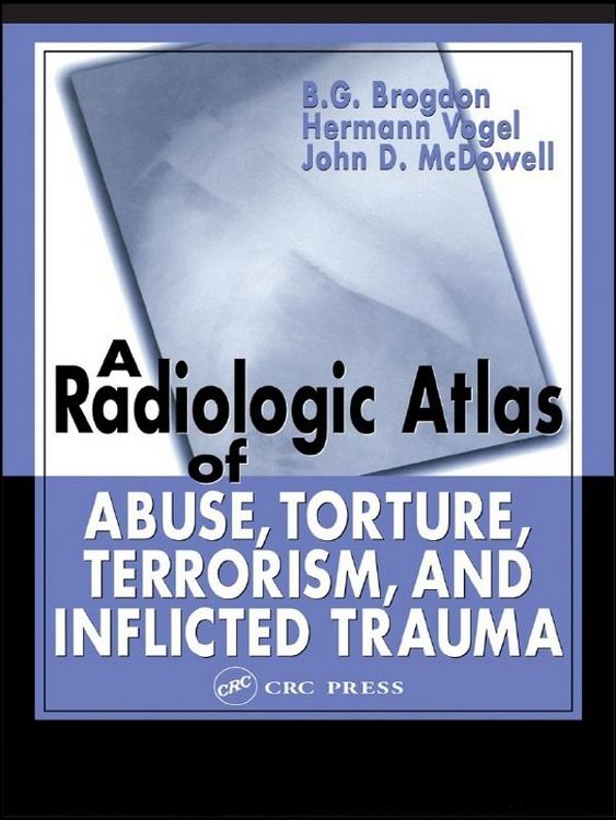 Produktbild: A Radiologic Atlas of Abuse, Torture, Terrorism, and Inflicted Trauma
