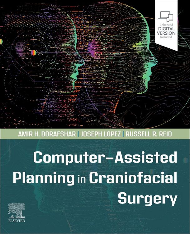 Produktbild: Computer-Assisted Planning in Craniofacial Surgery