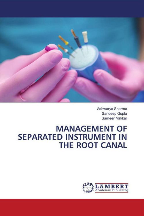 Produktbild: Management Of Separated Instrument in The Root Canal