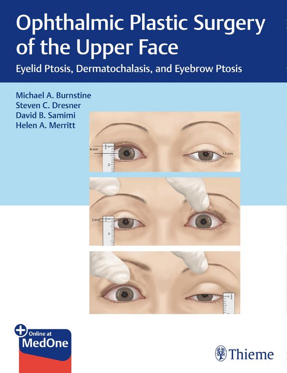 Produktbild: Ophthalmic Plastic Surgery of the Upper Face