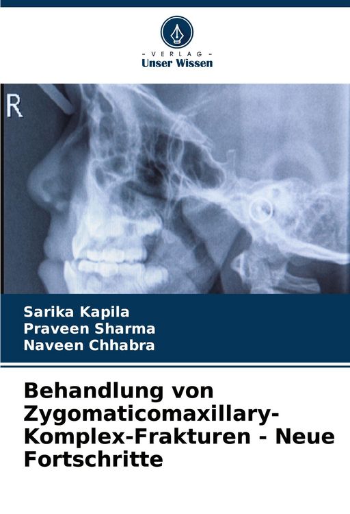 Produktbild: Behandlung von Zygomaticomaxillary-Komplex-Frakturen - Neue Fortschritte