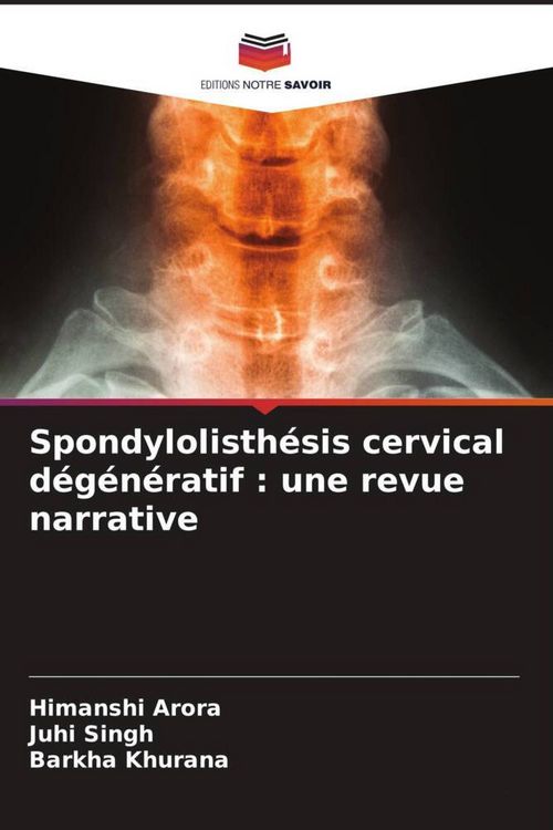 Produktbild: Spondylolisth&eacute;sis cervical d&eacute;g&eacute;n&eacute;ratif : une revue narrative