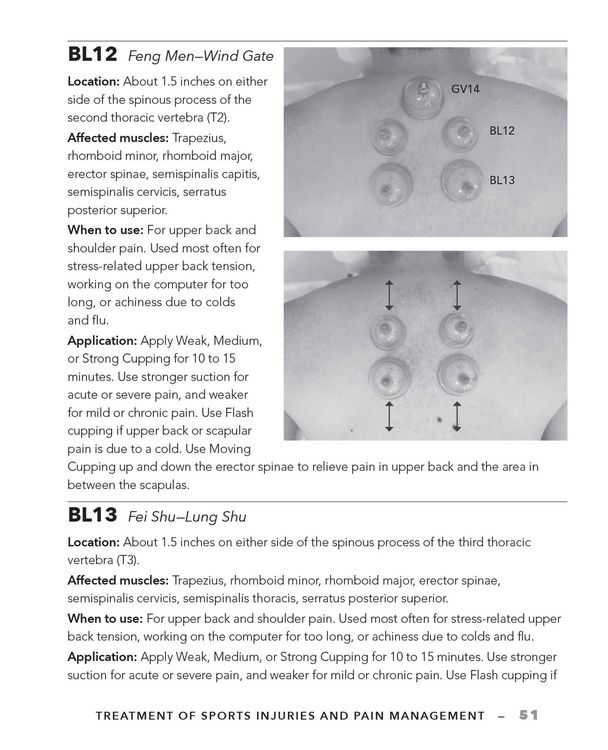 Produktbild: Cupping Therapy for Muscles and Joints