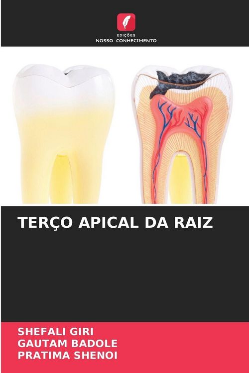 Produktbild: Ter&ccedil;o Apical Da Raiz