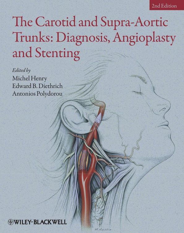 Produktbild: The Carotid and Supra-Aortic Trunks