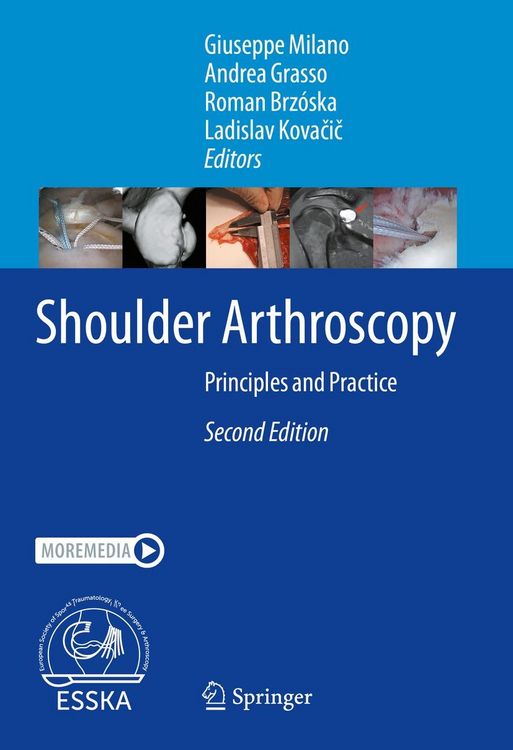 Produktbild: Shoulder Arthroscopy