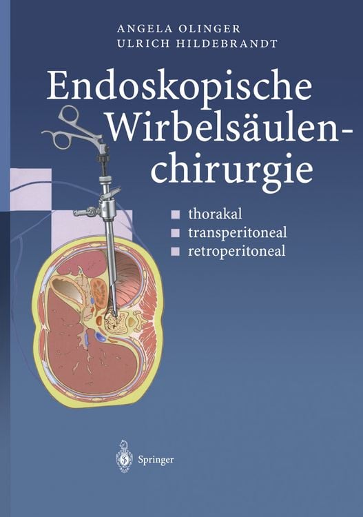 Produktbild: Endoskopische Wirbels&auml;ulenchirurgie