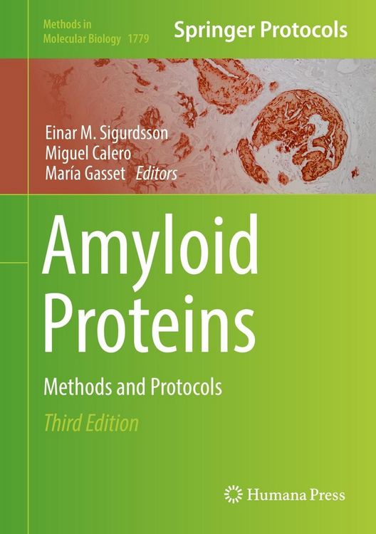 Produktbild: Amyloid Proteins