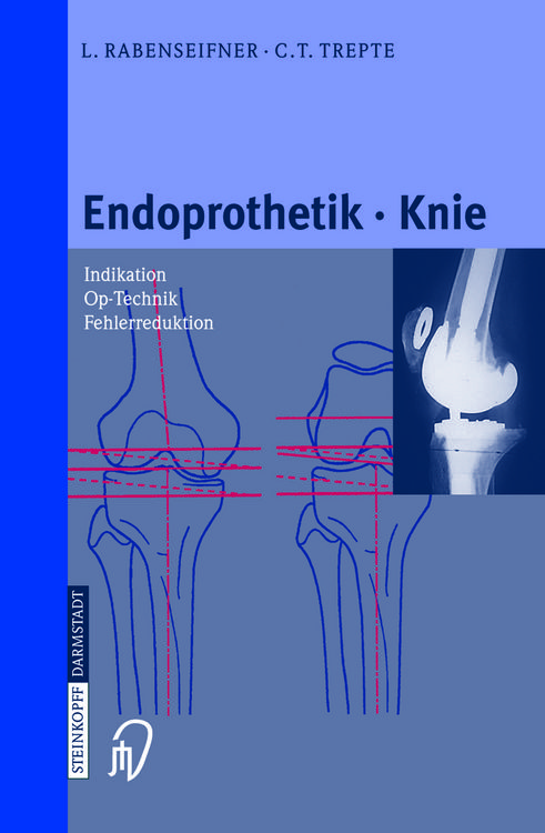 Produktbild: Endoprothetik Knie
