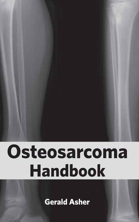 Produktbild: Osteosarcoma Handbook