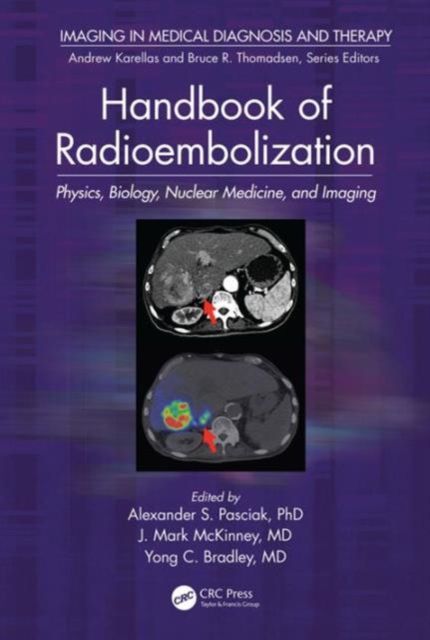 Produktbild: Handbook of Radioembolization