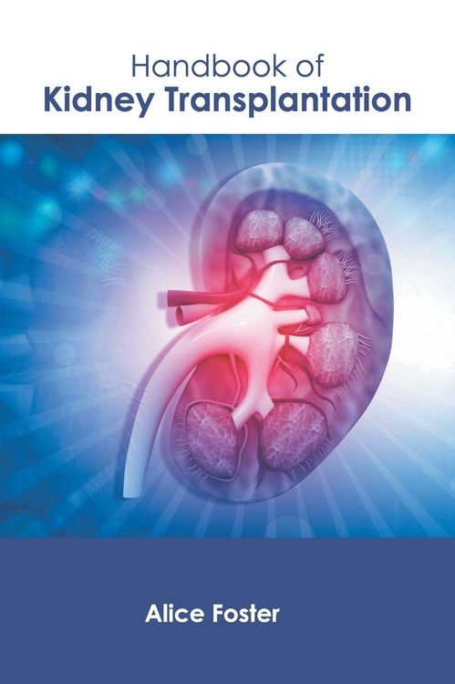 Produktbild: Handbook of Kidney Transplantation