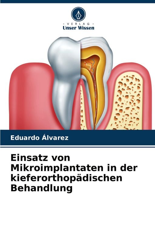 Produktbild: Einsatz von Mikroimplantaten in der kieferorthop&auml;dischen Behandlung