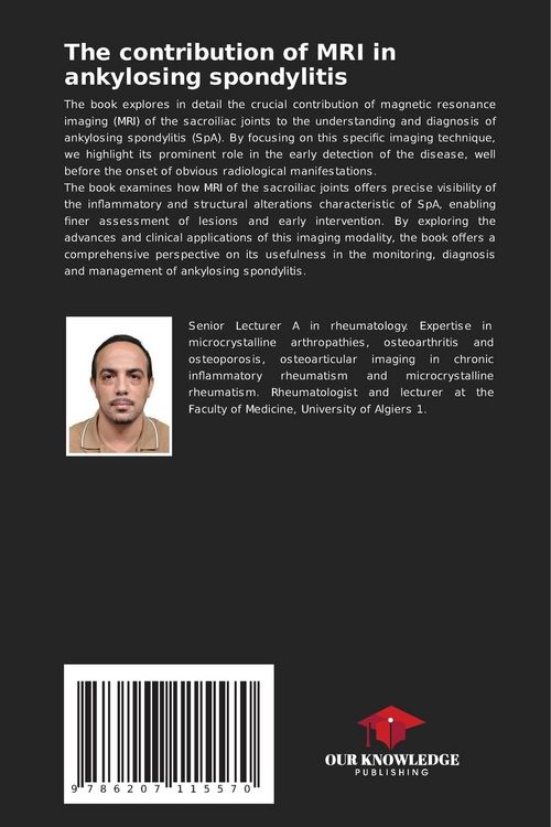 Produktbild: The contribution of MRI in ankylosing spondylitis