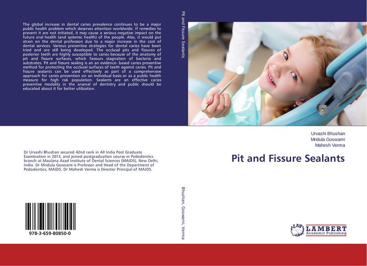 Produktbild: Pit and Fissure Sealants