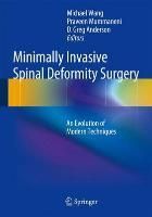 Produktbild: Minimally Invasive Spinal Deformity Surgery