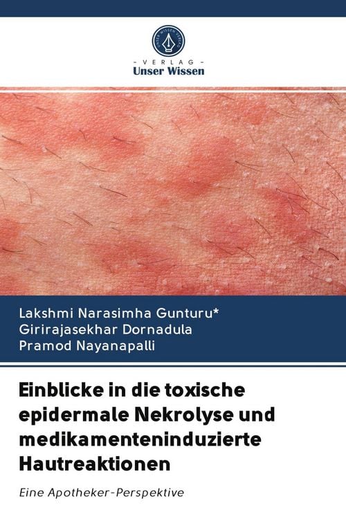 Produktbild: Einblicke in die toxische epidermale Nekrolyse und medikamenteninduzierte Hautreaktionen