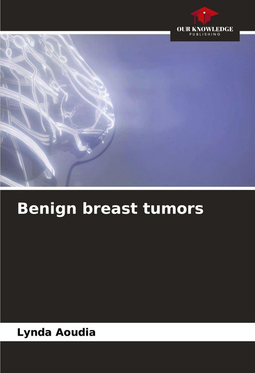 Produktbild: Benign breast tumors
