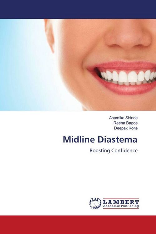 Produktbild: Midline Diastema