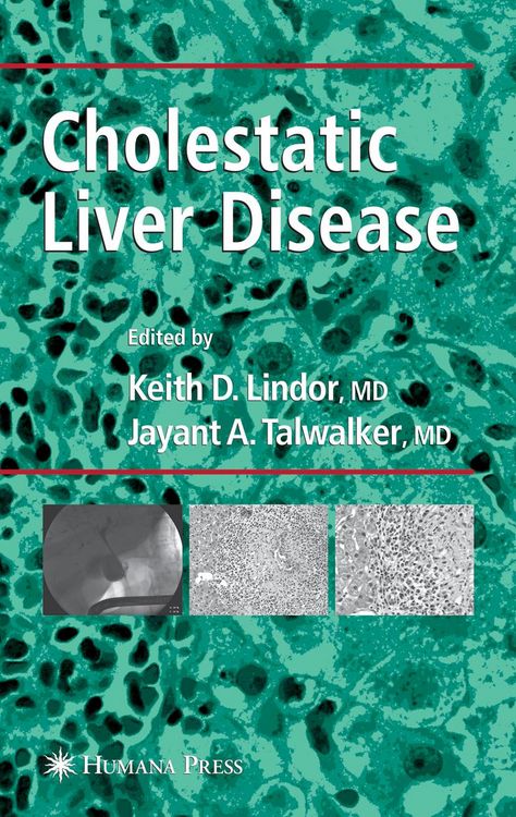 Produktbild: Cholestatic Liver Disease