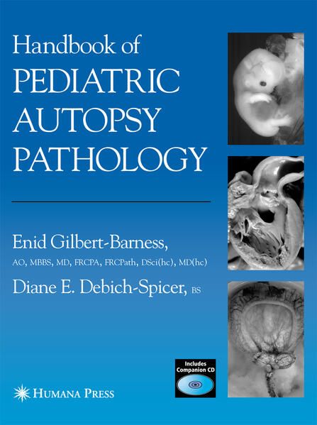 Produktbild: Handbook of Pediatric Autopsy Pathology