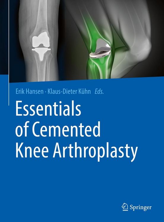 Produktbild: Essentials of Cemented Knee Arthroplasty