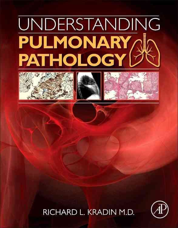 Produktbild: Kradin, R: Understanding Pulmonary Pathology