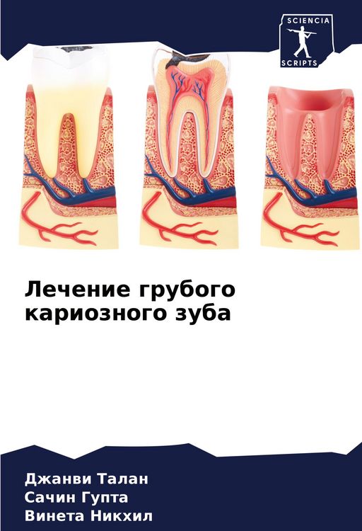 Produktbild: Lechenie grubogo karioznogo zuba