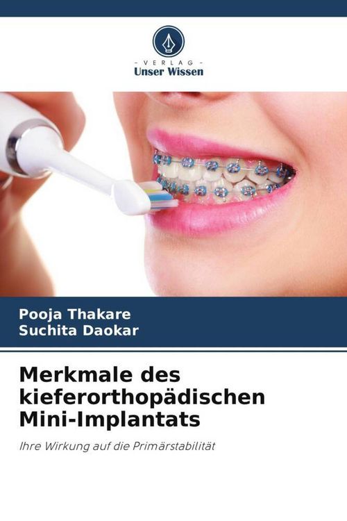 Produktbild: Merkmale des kieferorthop&auml;dischen Mini-Implantats