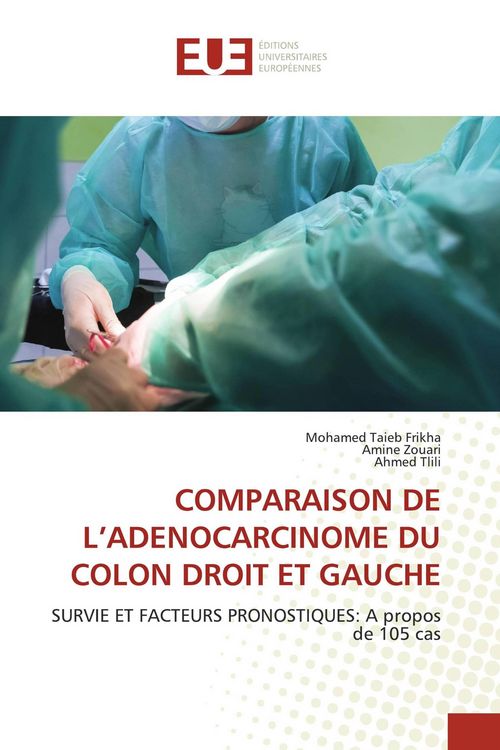 Produktbild: Comparaison De L'adenocarcinome Du Colon Droit Et Gauche