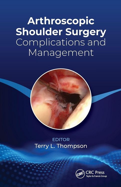 Produktbild: Arthroscopic Shoulder Surgery