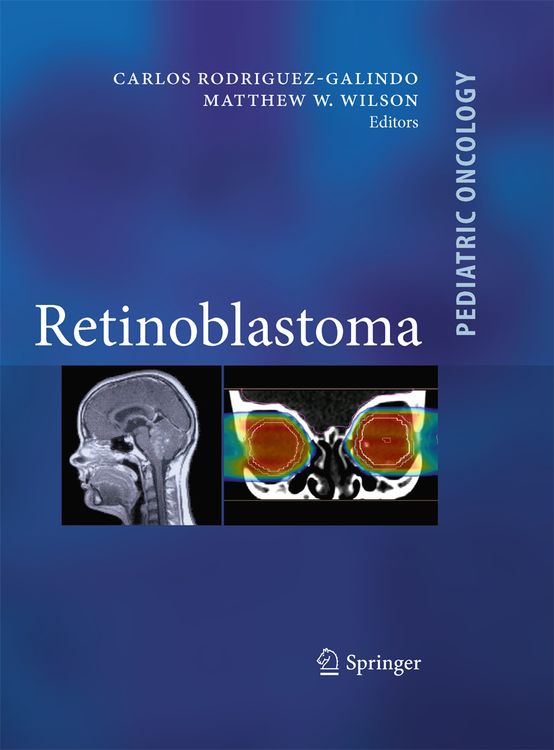 Produktbild: Retinoblastoma