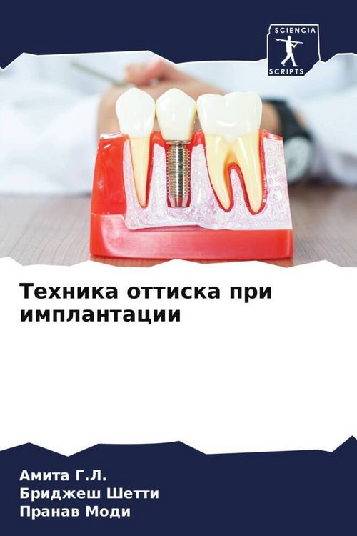 Produktbild: Tehnika ottiska pri implantacii