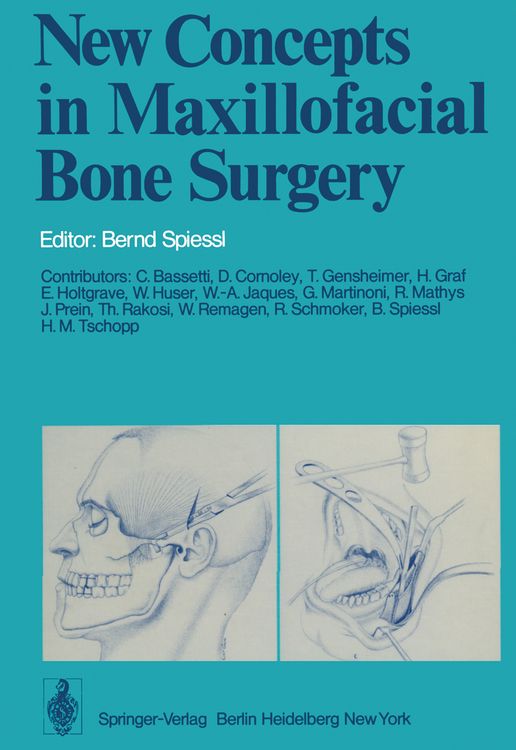 Produktbild: New Concepts in Maxillofacial Bone Surgery