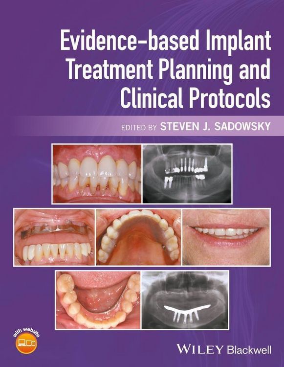 Produktbild: Evidence-based Implant Treatment Planning and Clinical Protocols