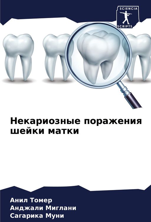 Produktbild: Nekarioznye porazheniq shejki matki
