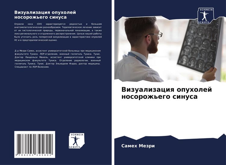 Produktbild: Vizualizaciq opuholej nosorozh'ego sinusa