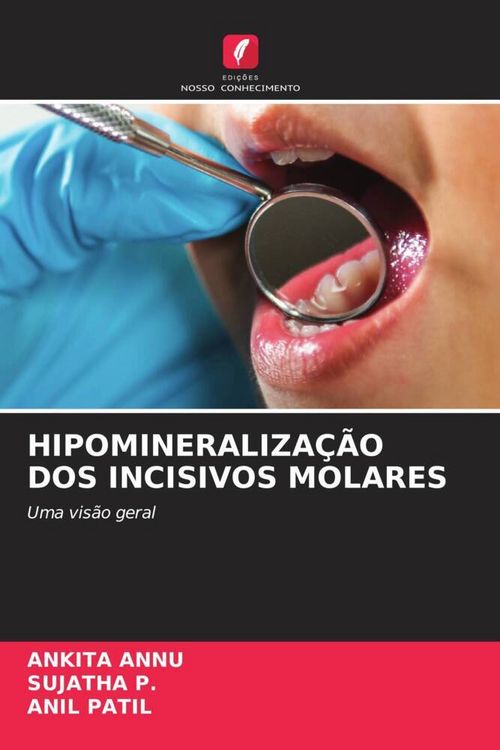 Produktbild: Hipomineraliza&ccedil;&atilde;o Dos Incisivos Molares