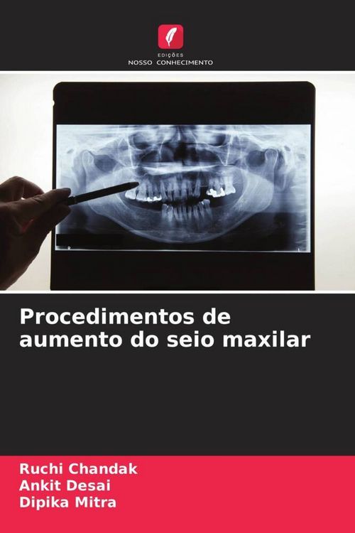 Produktbild: Procedimentos de aumento do seio maxilar