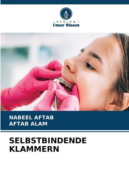 Produktbild: Selbstbindende Klammern