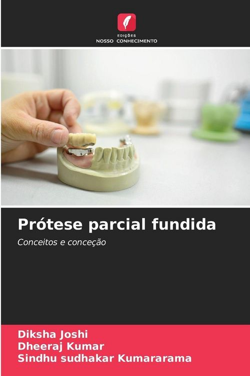 Produktbild: Pr&oacute;tese parcial fundida