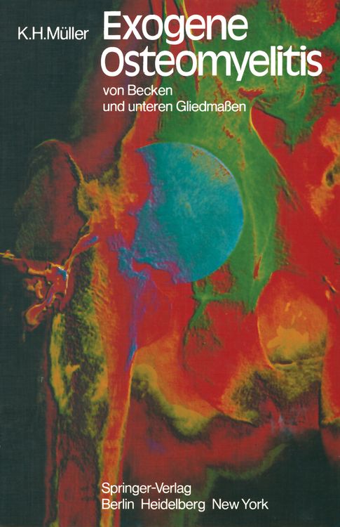 Produktbild: Exogene Osteomyelitis von Becken und unteren Gliedma&szlig;en
